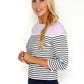 Stripe Top with Shoulder Button Detail