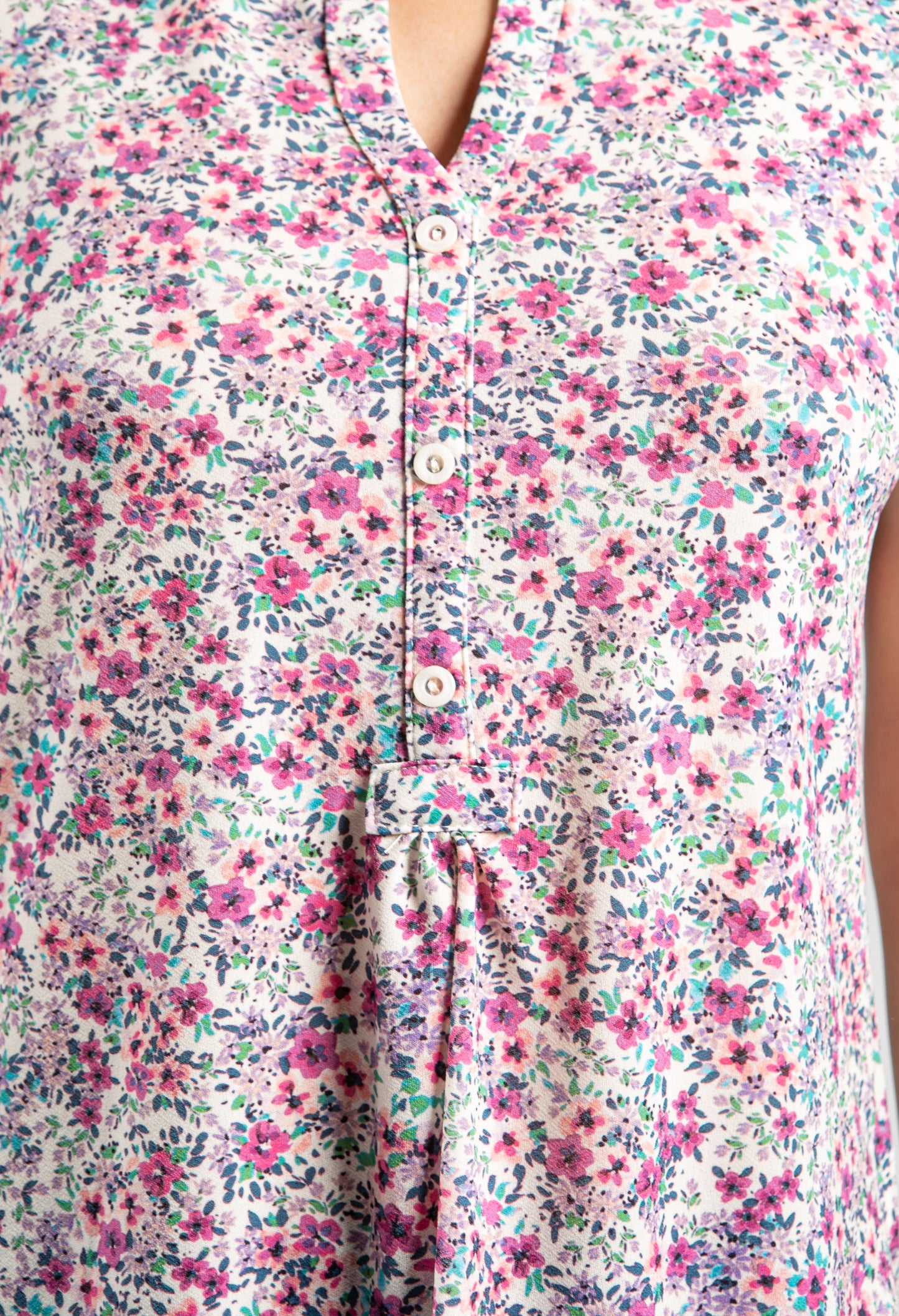 Button Detail Top -2